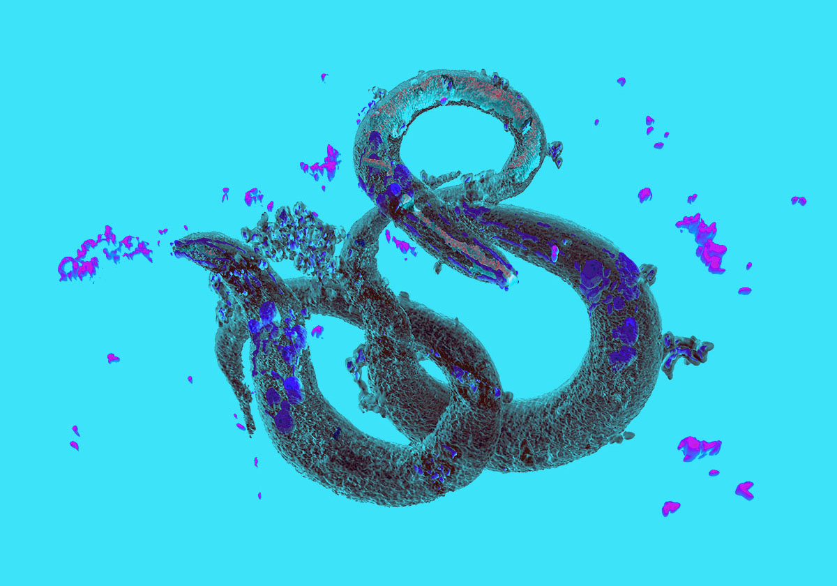 Insulin-mTOR hyperfunction drives C. elegans aging opposed by the megaprotein LPD-3