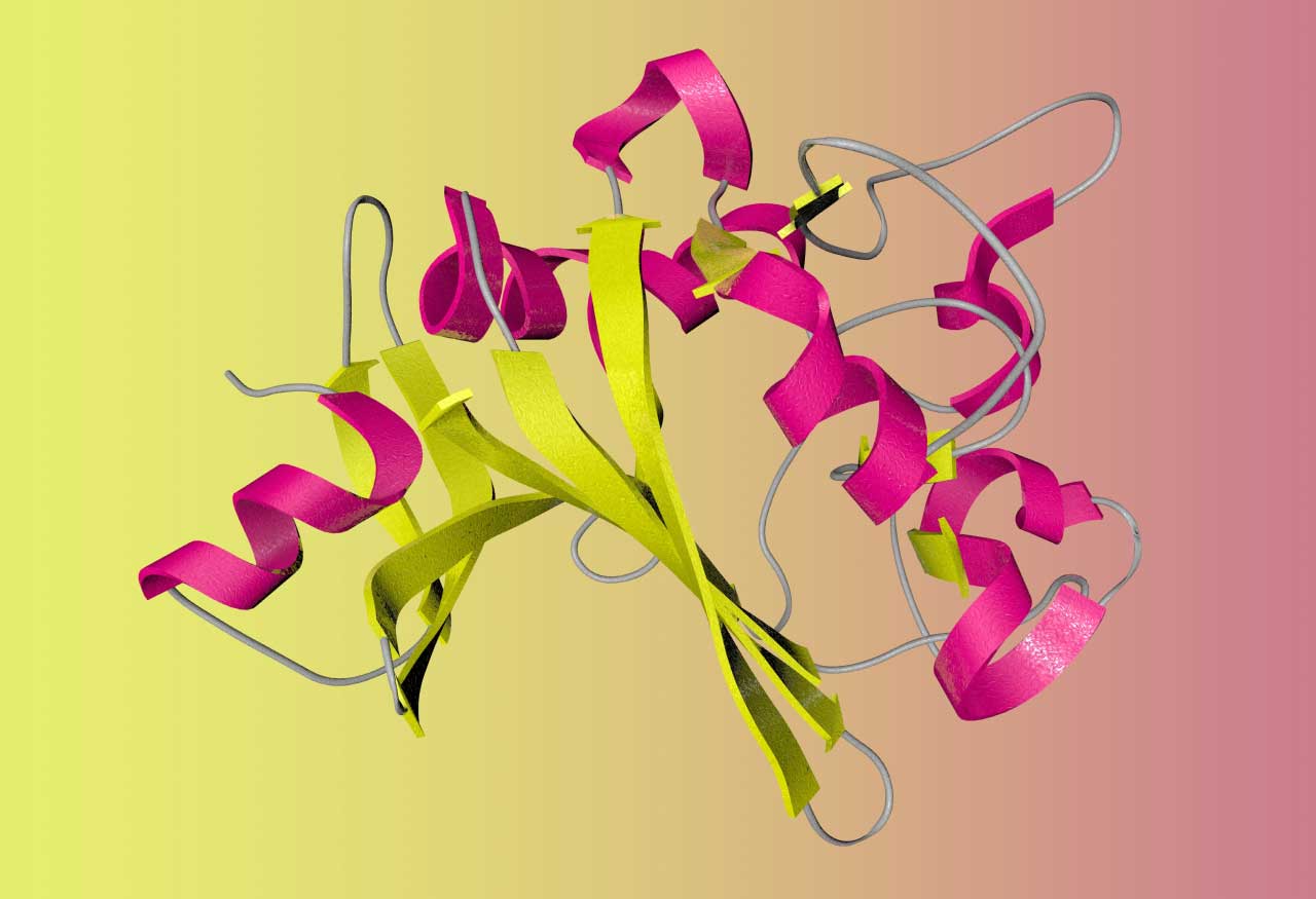 Impaired biogenesis of basic proteins impacts multiple hallmarks of the aging brain